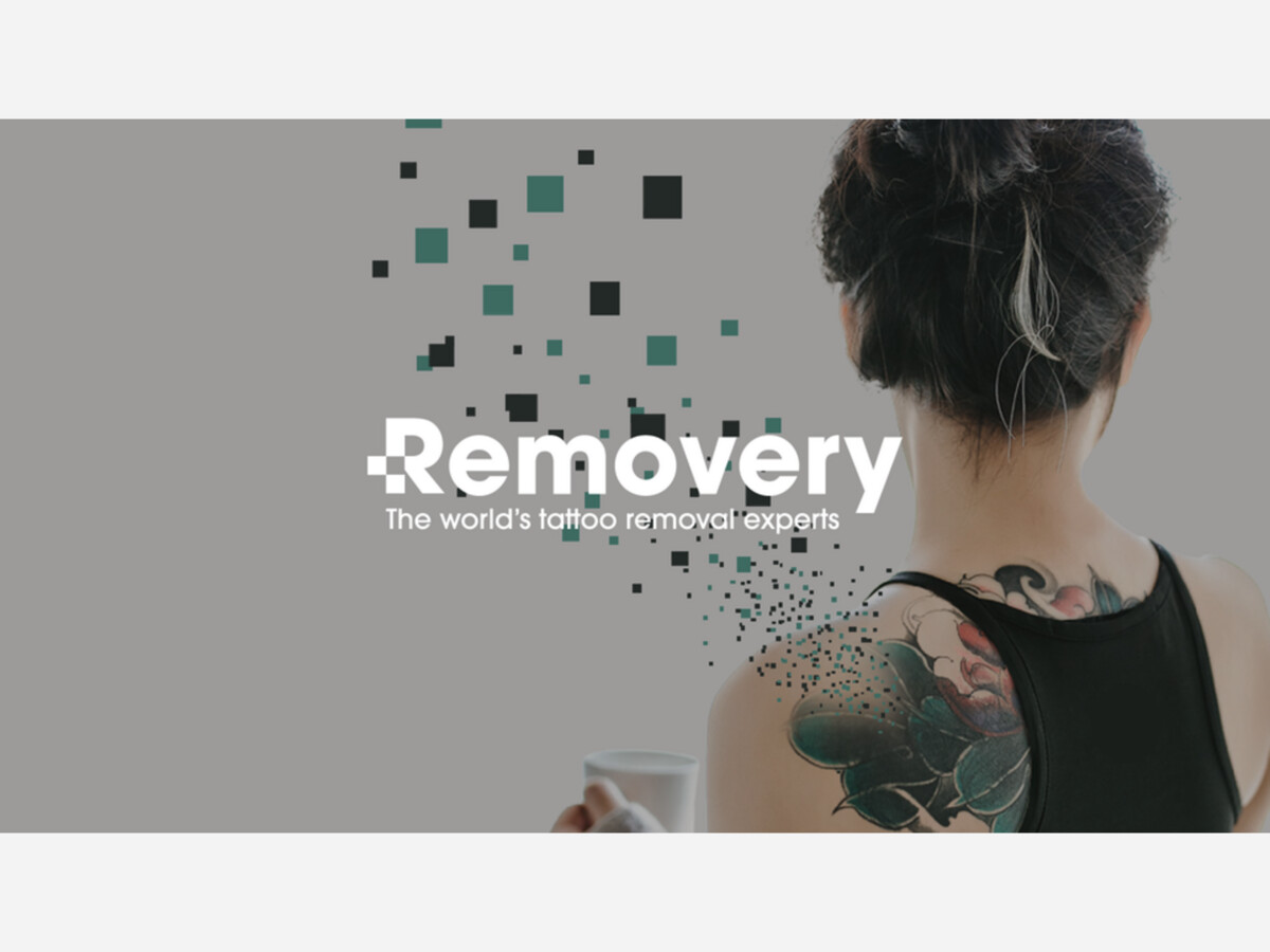 Tattoo removal at the beauty studio in County Durham